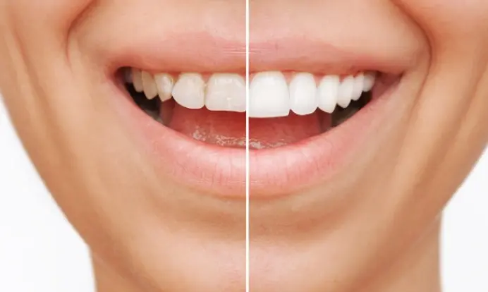 Cosmetic Dentistry